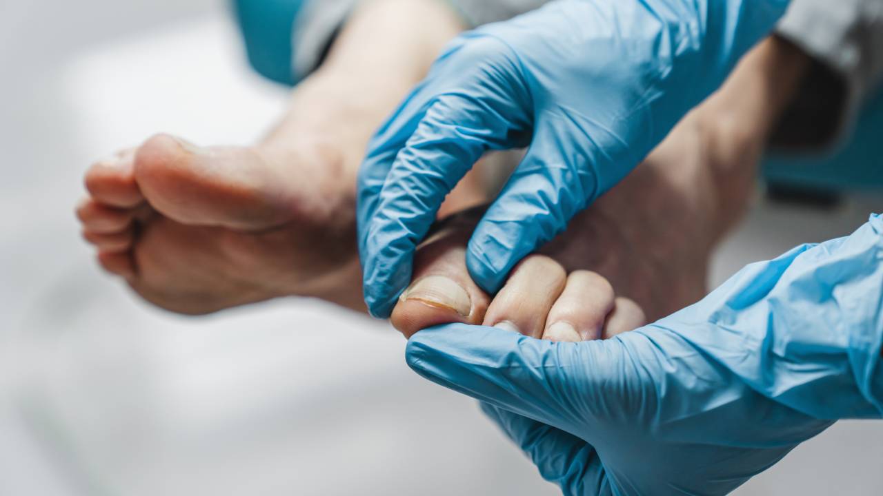 Foot Injuries