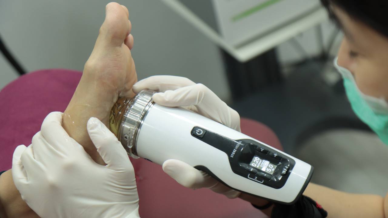 Management of Carcot Foot