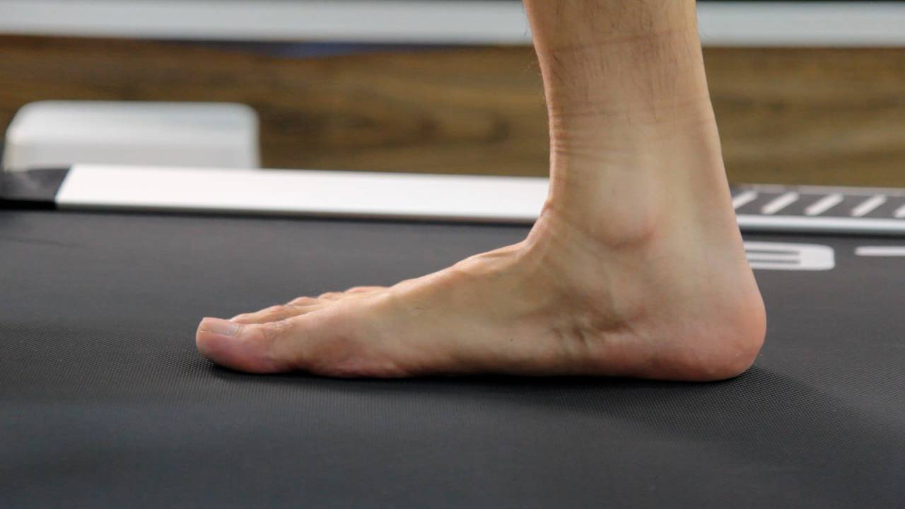 Gait Assessment