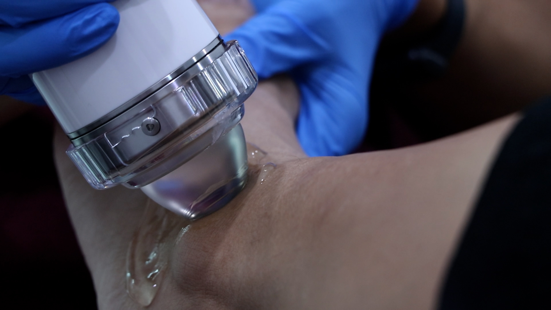 shockwave-therapy